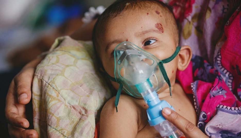 হাম শিশু Measles